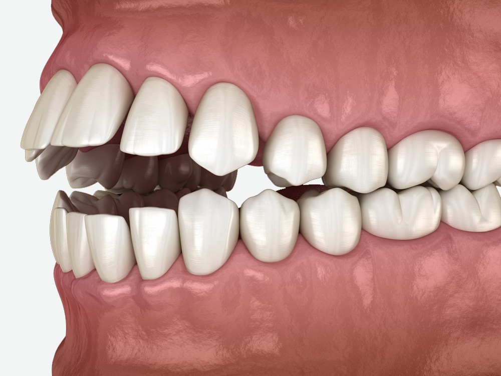 ocluzologie constanta, stomatologie constanta, alya medical center, dentist constanta