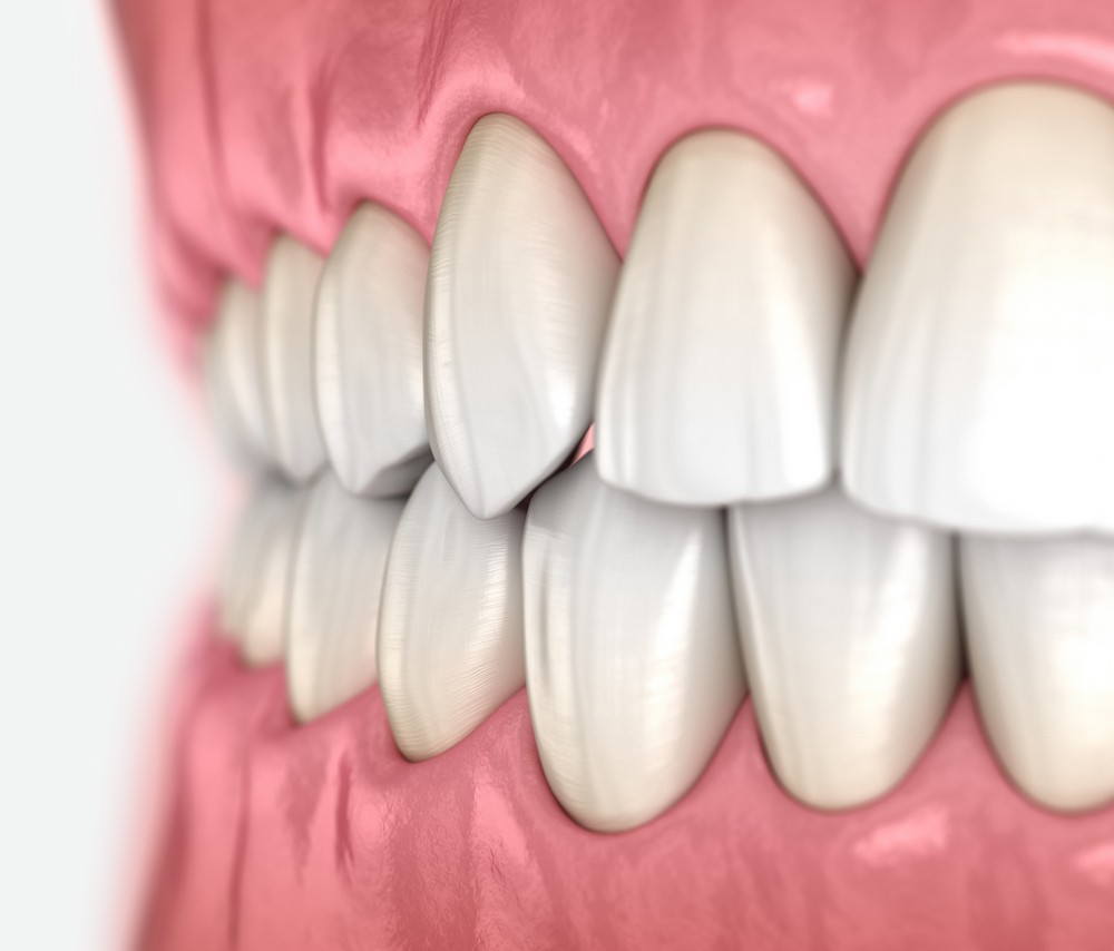 ocluzologie constanta, stomatologie constanta, alya medical center, dentist constanta
