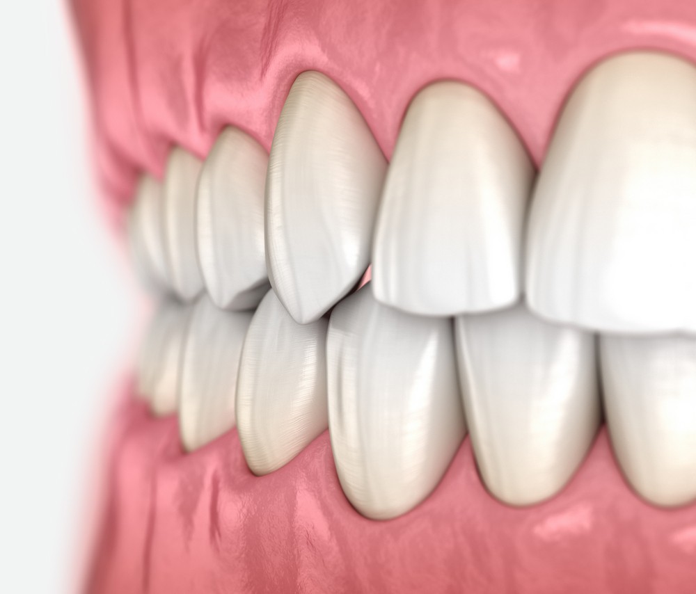 ocluzologie constanta, stomatologie constanta, alya medical center, dentist constanta