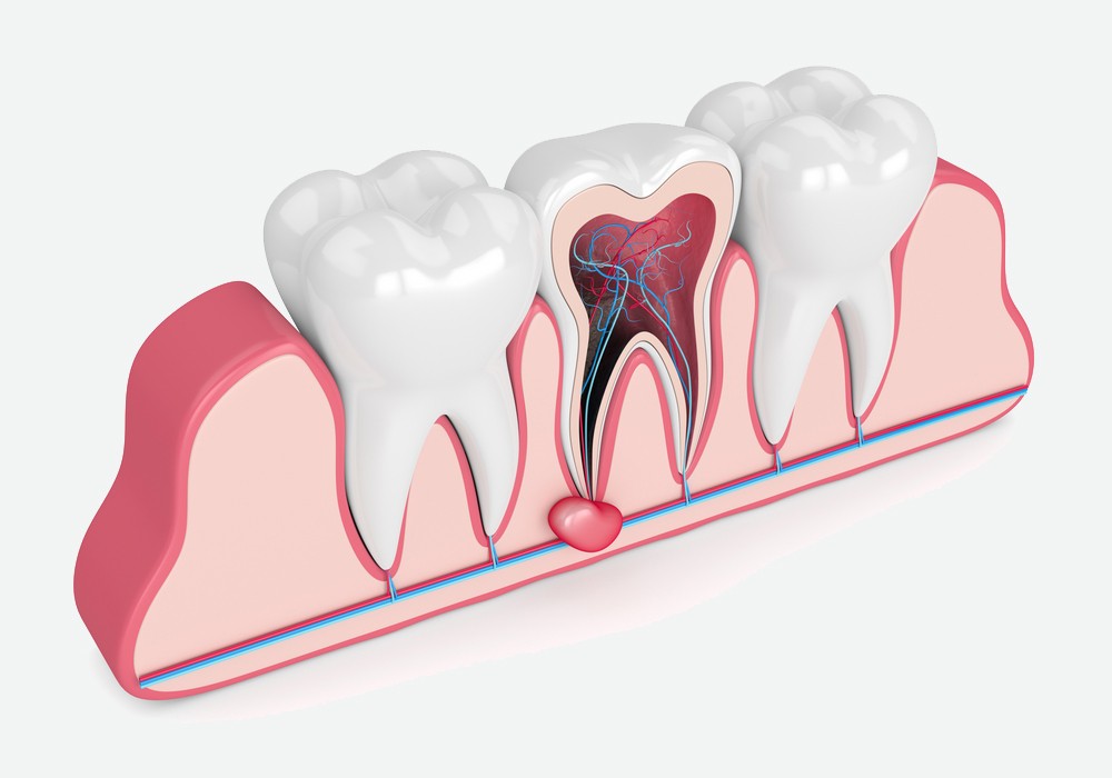 tratament canal constanta, alya medical center, stomatologie constanta, dentist constanta