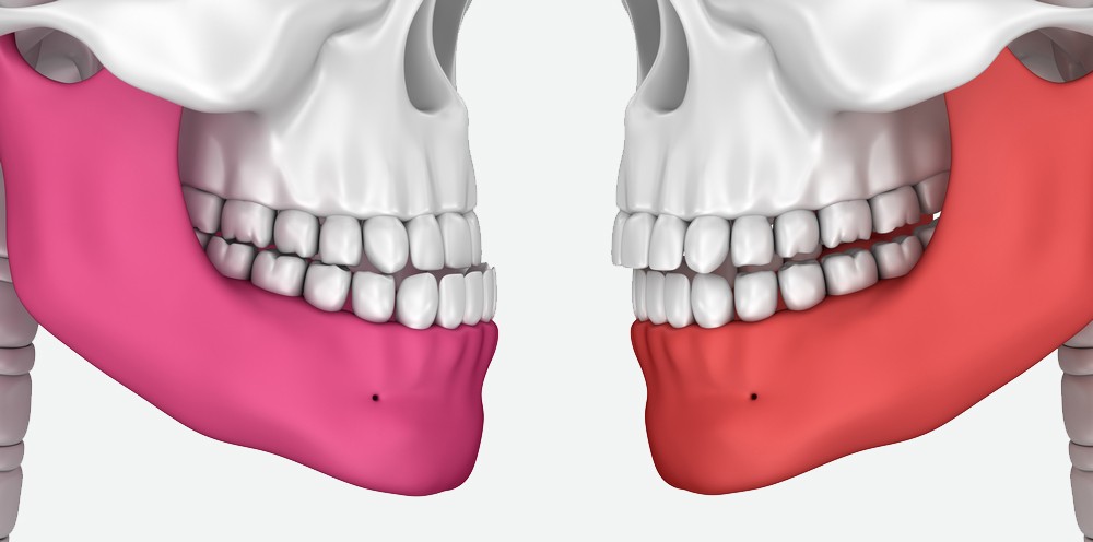 ocluzologie constanta, stomatologie constanta, alya medical center, dentist constanta