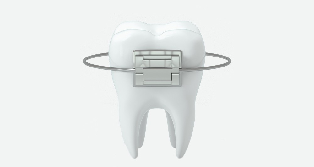 alya medical center, ortodontie constanta, stomatologie constanta, aparat dentar constanta, dentist